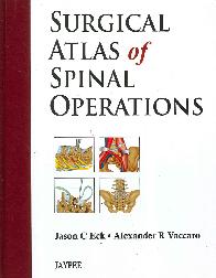 Surgical Atlas of Spinal Operations