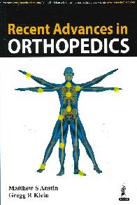 Recent Advances in Orthopedics