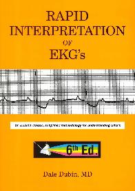 Rapid interpretation of EKG's