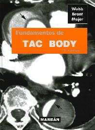 Fundamentos de TAC BODY