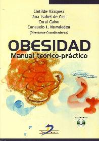 Obesidad