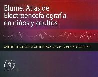 Atlas de electroencefalografa en nios y adultos
