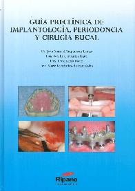 Gua preclnica de implantologa, periodoncia y ciruga bucal