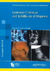Lesiones Cr�nicas del Tobillo en el Deporte