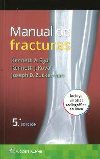 Manual de fracturas