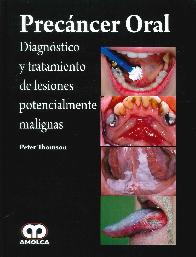 Precncer oral