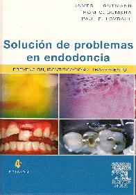 Solucion de Problemas en Endodoncia