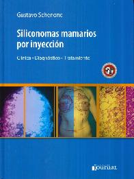 Siliconomas mamarios por inyecci�n. Cl�nica, diagn�stico, tratamiento