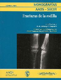 Fracturas de Rodilla Monograf�as AAOS-SECOT N�mero 2 / 2009