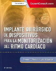 Implante Quirrgico de Dispositivos para la Monitorizacin del Ritmo Cardiaco