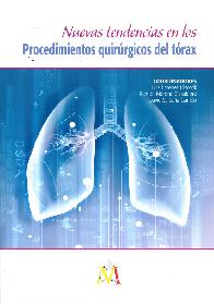 Nuevas Tendencias en los Procedimientos Quirrgicos del Trax