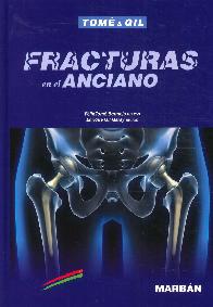 Fracturas en el Anciano Tom� & Gil