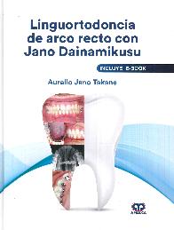 Linguortodoncia de arco recto con Jano Dainamikusu