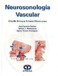 Neurosonolog�a Vascular