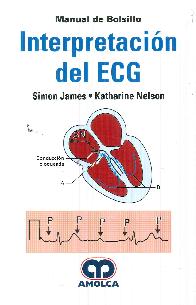 Interpretacin del ECG