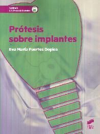 Pr�tesis sobre implantes