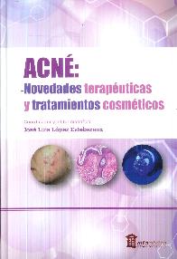 Acn: Novedades teraputicas y tratamientos cosmticos