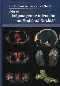 Atlas de Inflamaci�n en Infecci�n en Medicina Nuclear