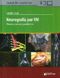 Neurograf�a por RM