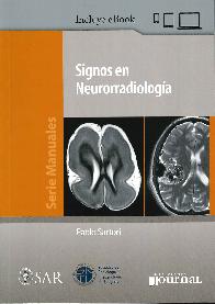 Signos en Neurorradiolog�a