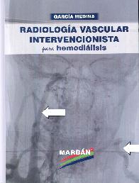Radiologa Vascular Intervencionista para Hemodilisis