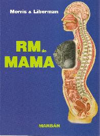 Morris & Liberman RM de mama