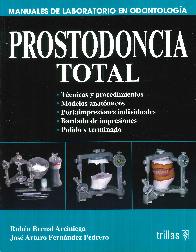 Prostodoncia total