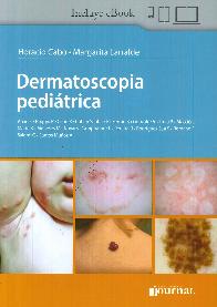 Dermatoscopia peditrica