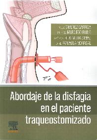 Abordaje de la disfagia en el paciente traqueostomizado