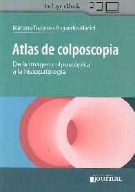 Atlas de colposcopia. De la imagen colposcpica a la histopatologa
