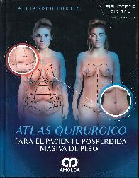 Atlas quirurgico para el paciente posprdida masiva de peso