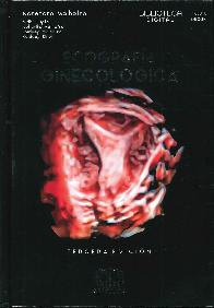Ecografa ginecolgica