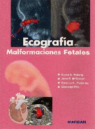 Ecografia en Malformaciones Fetales