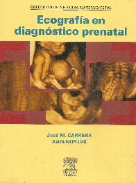 Ecografia en Diagnostico Prenatal