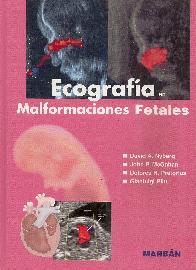 Ecografia en Malformaciones Fetales