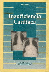 Insuficiencia cardaca