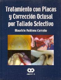 Tratamiento de Placas y Correcci�n Oclusal por Tallado Selectivo