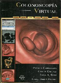 Colonoscopa Virtual
