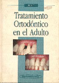Tratamiento ortodontico en el adulto