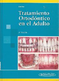 Tratamiento Ortod�ntico en el Adulto