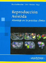Reproduccion Asistida