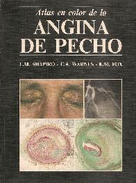 Atlas en color de la Angina de pecho