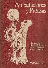 Amputaciones y protesis