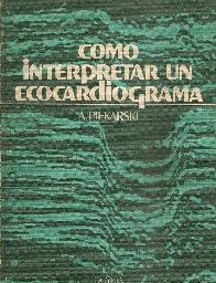 Como interpretar un ecocardiograma