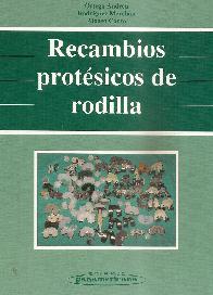 Recambios prosteticos de rodilla