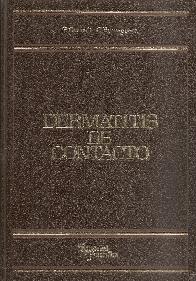 Dermatitis de contacto
