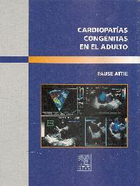 Cardiopatias Congenitas en el Adultos