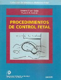 Procedimientos de control fetal
