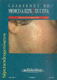 Hiperandrogenismo Vol 2 Numero 2