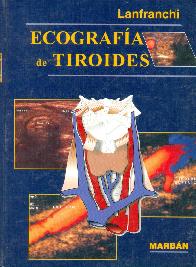 Ecografia de tiroides